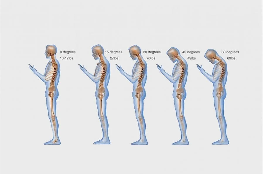 Text-Neck